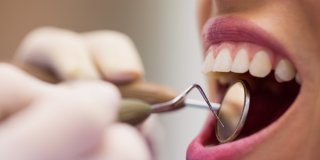 haciendo un examen de la salud bucodental