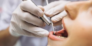 funciones higienista dental