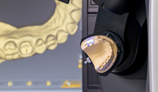 Recreación dental y detalle de la misma en programa CAD-CAM