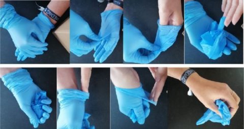 Cómo quitar guantes infectados